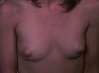 Stephanie Fondue Nude